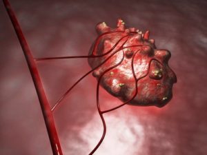 u nang buong trung - nguyen nhan va tac hai