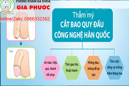 phuong phap dieu tri hien dai nhat hien nay