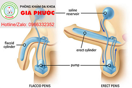 hinh anh roi loan cuong duong o nam gioi
