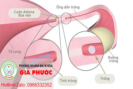 Hinh anh tac ong dan trung