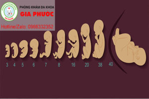 tuoi thai cang lon thi chi phi pha thai se cang cao