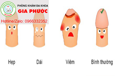 cac dang benh ly cua bao quy dau