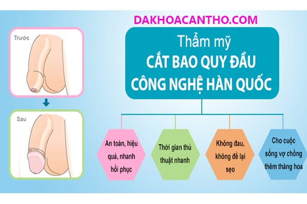Cat bao quy dau tri xuat tinh som