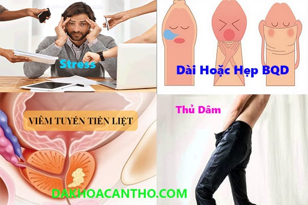 Nguyen nhan xuat tinh som