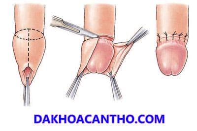 Phuong phap truyen thong