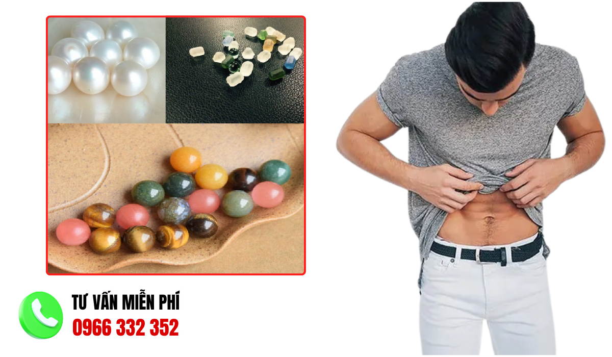 101+ Hình Ảnh Gắn Bi Cho Nam: Các Kiểu Gắn Và Lợi Ích
