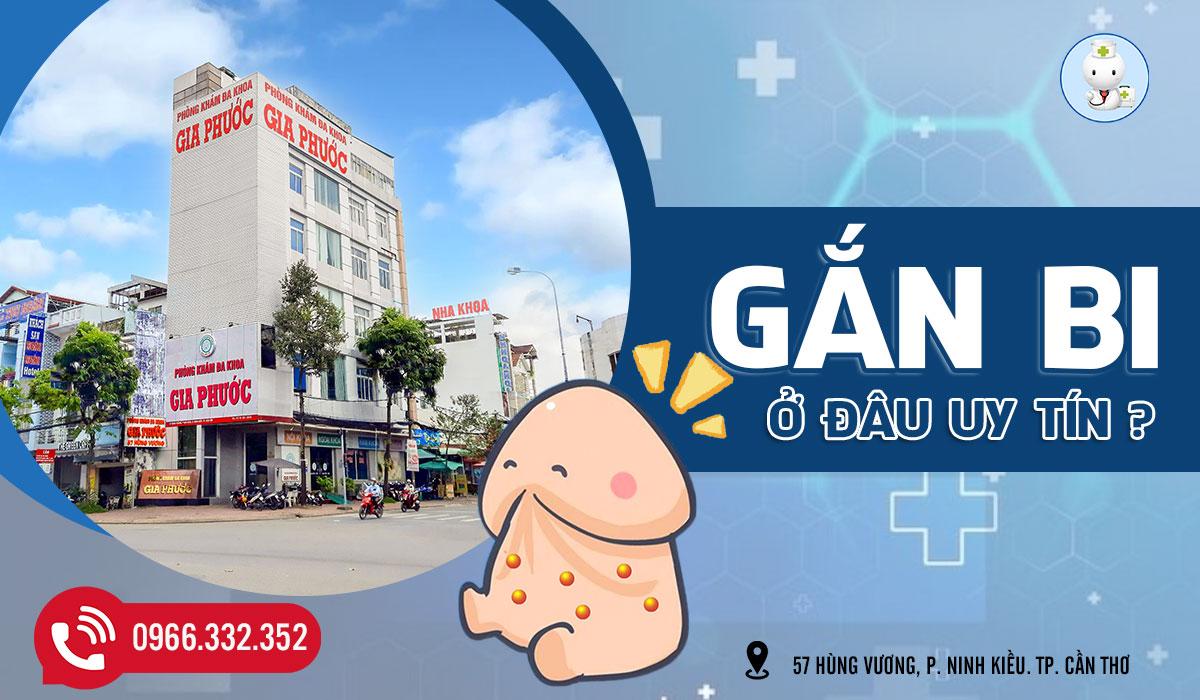 Gắn Bi Ở Đâu Uy Tín Tại Cần Thơ? Địa Chỉ An Toàn, Bảo Mật Cho Nam Giới