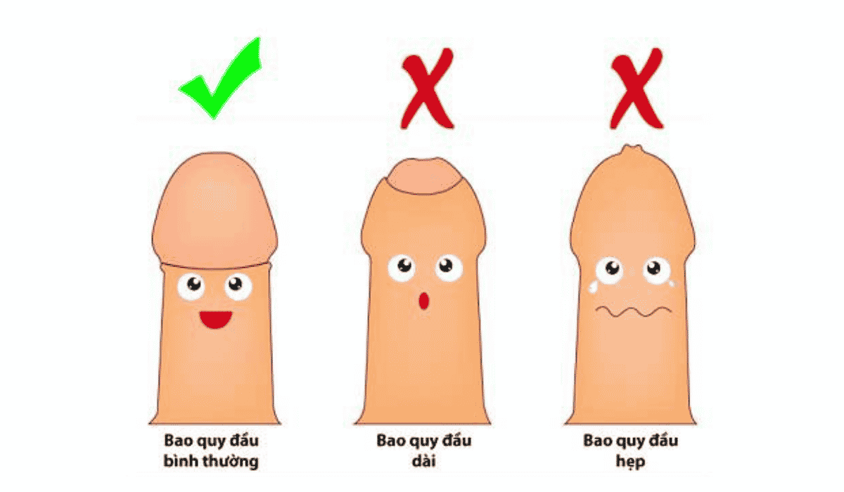 Top 4 Địa Chỉ Cắt Bao Quy Đầu Cà Mau Uy Tín