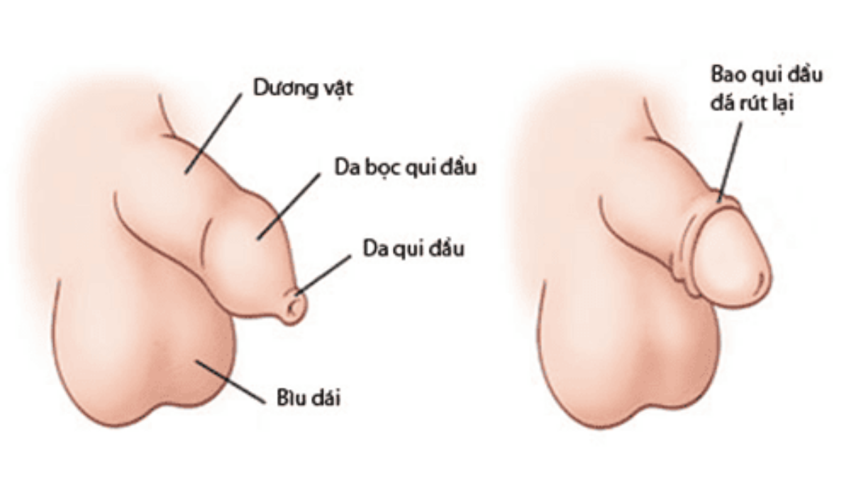 Top 4 Địa Chỉ Cắt Bao Quy Đầu Vĩnh Long