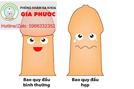 hep bao quy dau co sao khong
