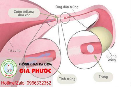 Hinh anh tac ong dan trung