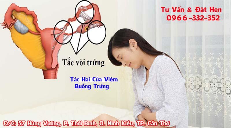 Viêm buồng trứng có triệu chứng như thế nào? | Đa khoa Cần Thơ