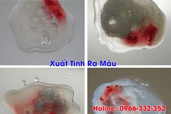 xuất tinh ra máu