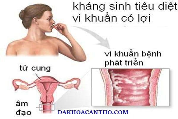 Dieu tri viem am dao man tinh