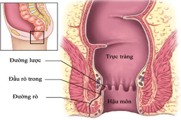 Hậu môn có mụn mủ