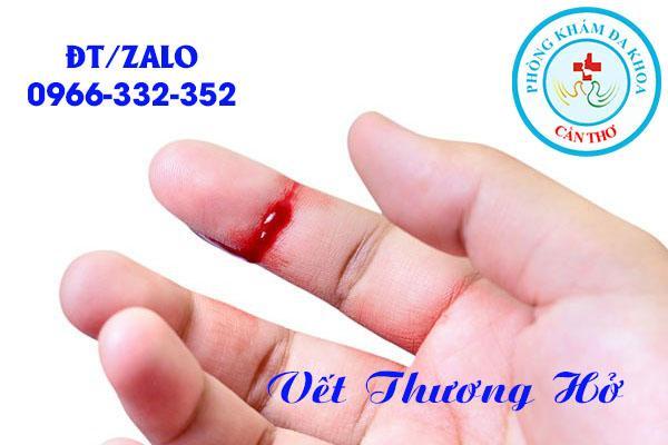 người bệnh lậu có vết thương hở