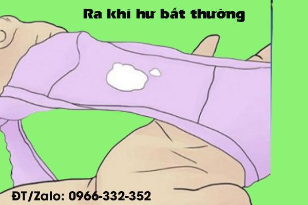 ra khí hư bất thường