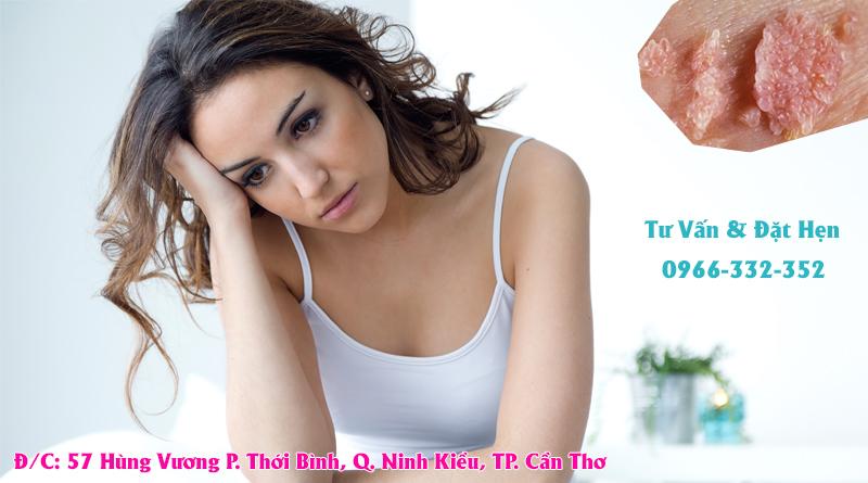 Sùi Mào Gà Là Bệnh Gì?