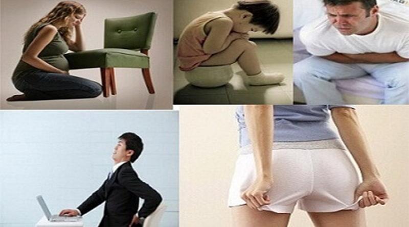 Bệnh trĩ thường gặp ở độ tuổi nào? | Bệnh ngoại khoa | Đa khoa Cần Thơ