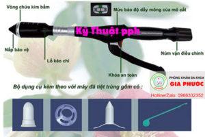 Kỹ thuật PPH trong điều trị trĩ ngoại
