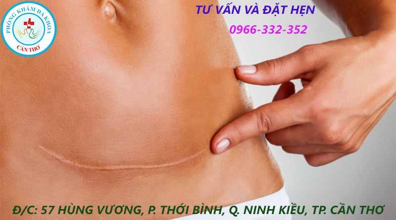 Sau sinh mổ phá thai bằng thuốc có được không? | Đa khoa Gia Phước