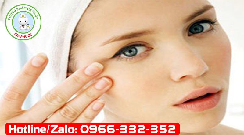 Bệnh Sùi mào gà ở mắt biểu hiện như thế nào? | Đa khoa Gia Phước