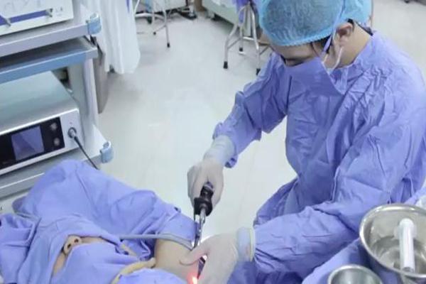 Công nghệ noi soi hút bỏ tuyến mồ hôi nách