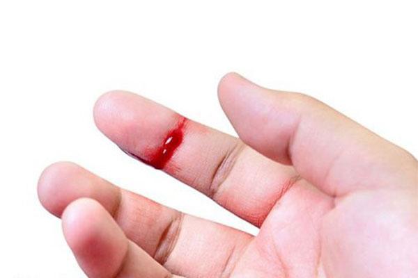 Bệnh giang mai lây nhiễm từ vết thương hở