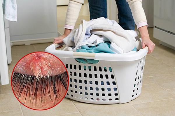 Lây nhiễm sùi mào gà do dùng chung quần áo
