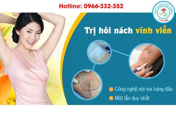 loại bỏ mồ hôi nách bằng công nghệ nội soi