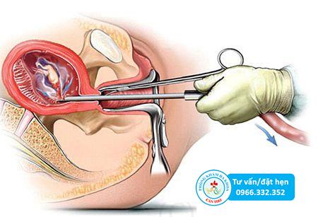 Phá thai 3 tháng tuổi an toàn và hiệu quả tại Cần Thơ | Đa khoa Cần Thơ
