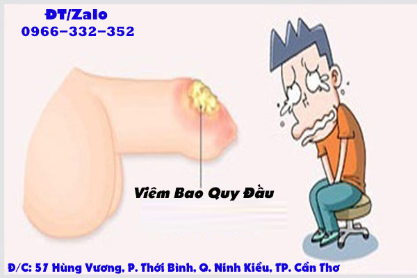 viêm bao quy đầu có nguy hiểm không