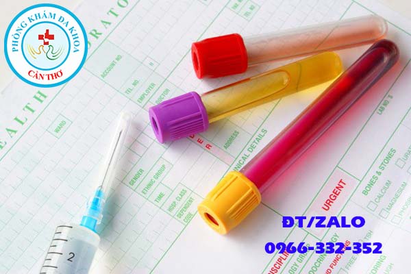 mẫu để làm xét nghiệm