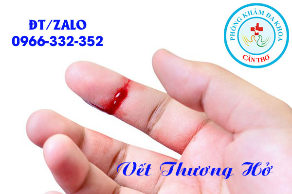 người bệnh lậu có vết thương hở