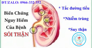 Tổng hợp những bài thuốc chữa sỏi thận