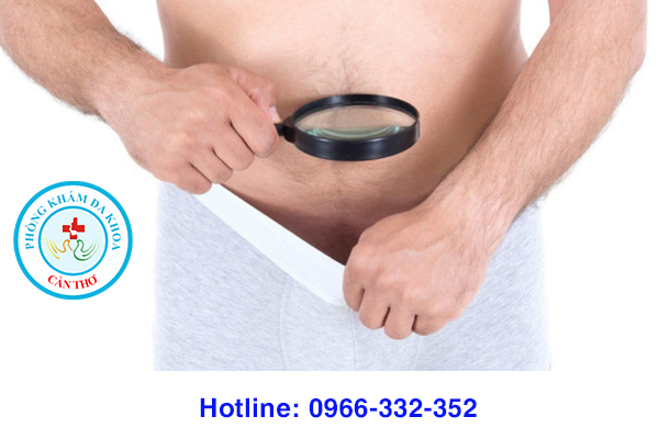 chọn mặc loại quần rộng thoáng sau khi cắt bao quy đầu