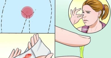 Khí hư bất thường